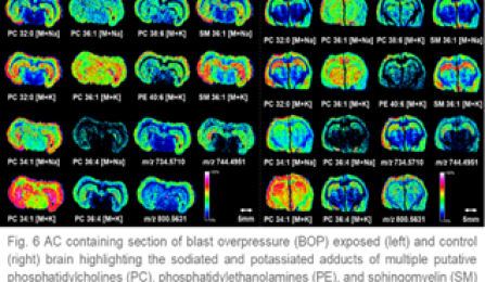 Images of brain scans highlighting levels of sodium and potasium. 